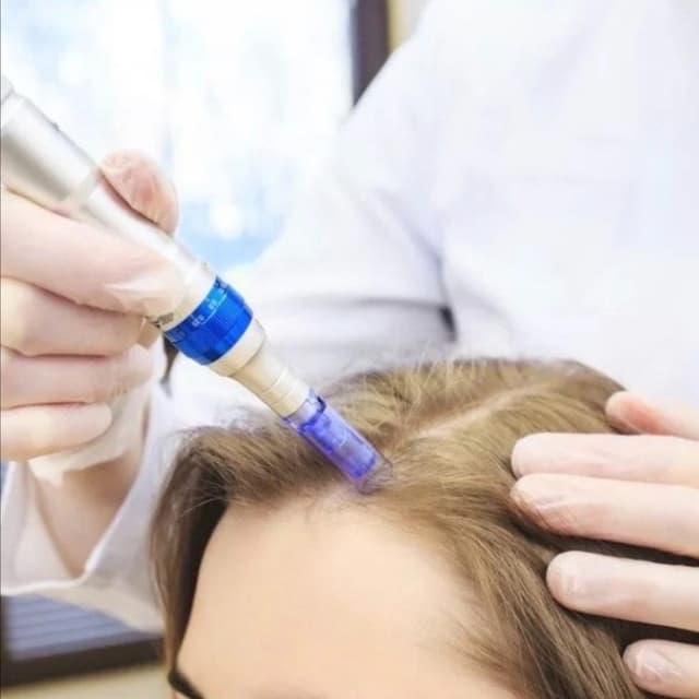 Anti-Hair Loss Microneedling at MILA STYLE Face&Body in Dallas, TX